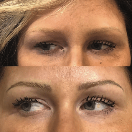 Before and After Image: Permanent Cosmetics - other