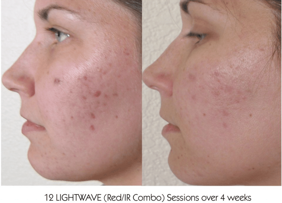 Before and After Image: Lightwave LED - other