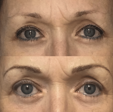 Before and After Image: Permanent Cosmetics - other