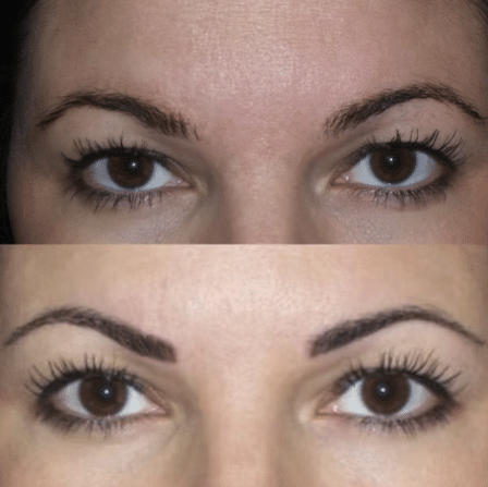 Before and After Image: Permanent Cosmetics - other