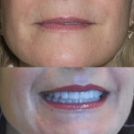 Before and After Image: Permanent Cosmetics - other