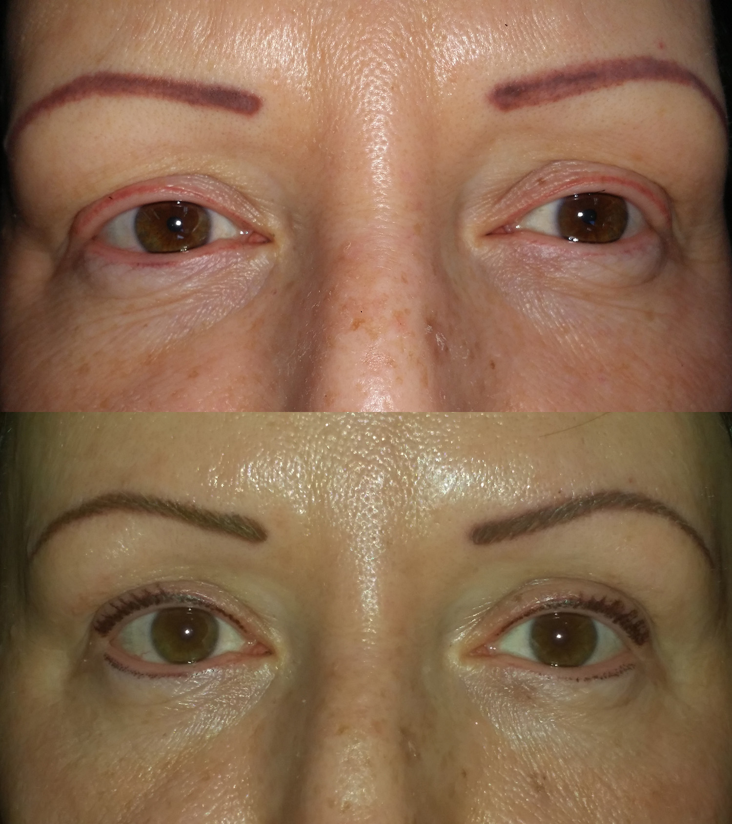 Before and After Image: Brow & Eyeliner Correction - front