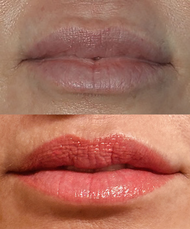 Before and After Image: Lip Blushing - front