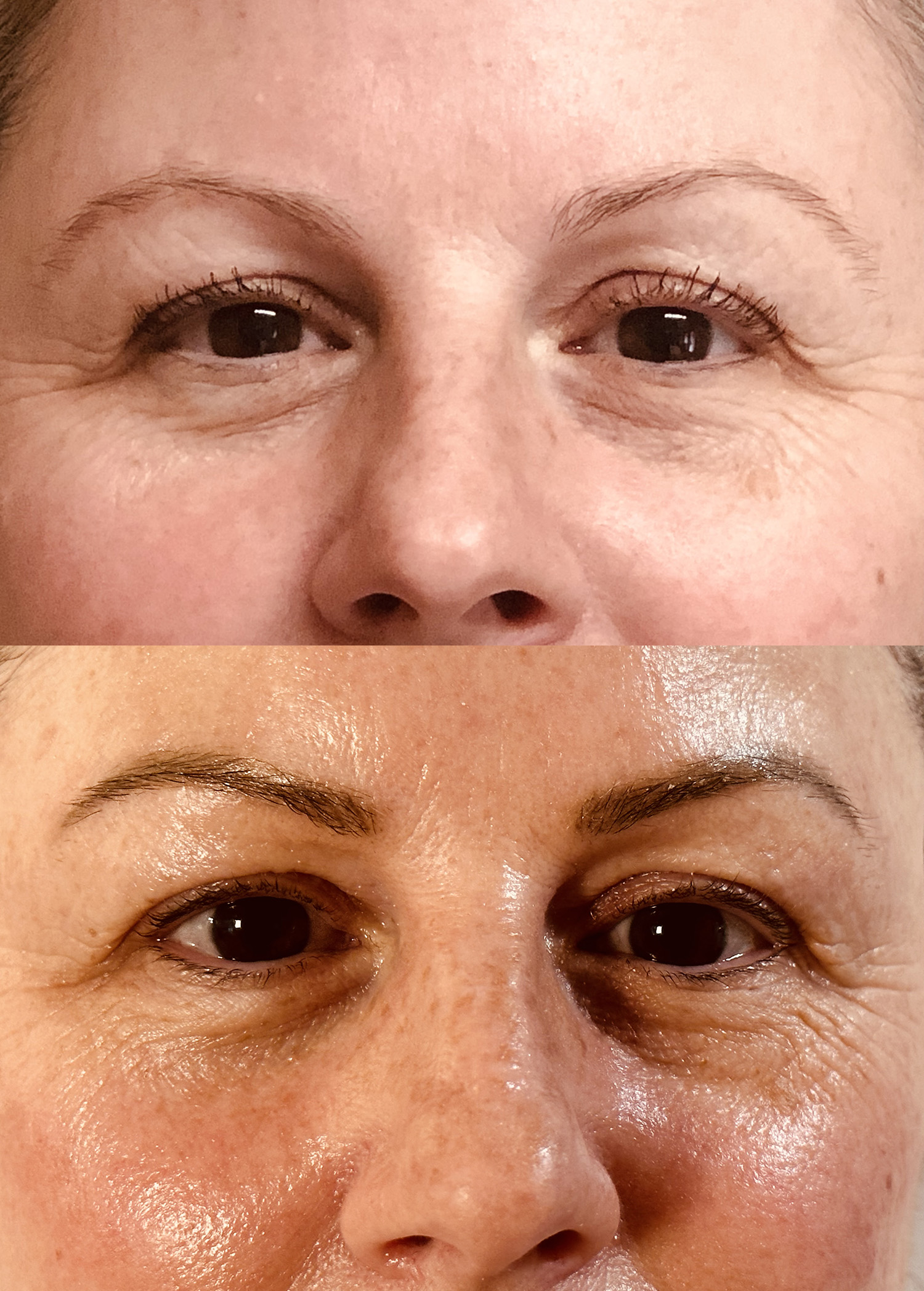 Before and After Image: Permanent Makeup Brows - front