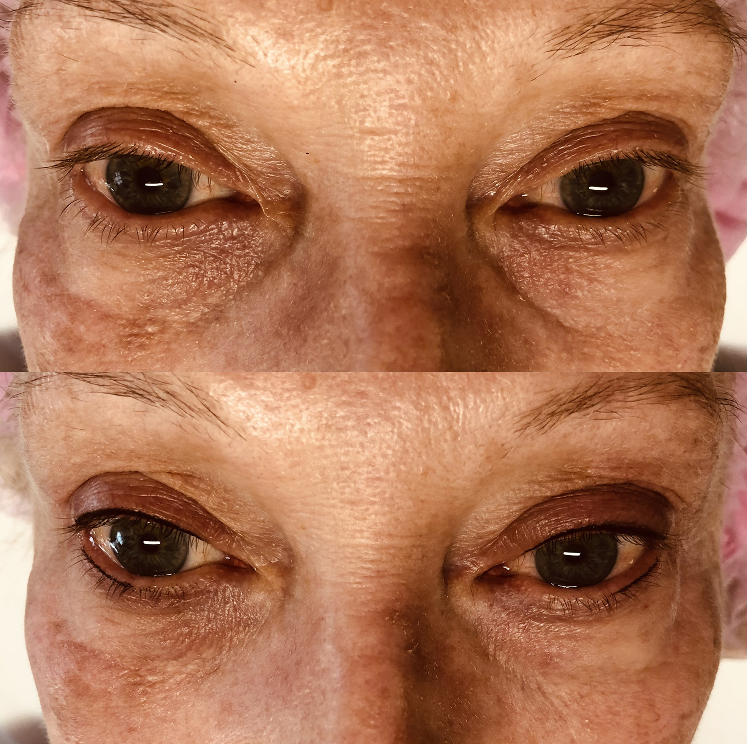 Before and After Image: Semi-Permanent Eyeliner - front