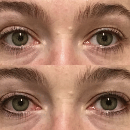 Before and After Image: Permanent Cosmetics - other