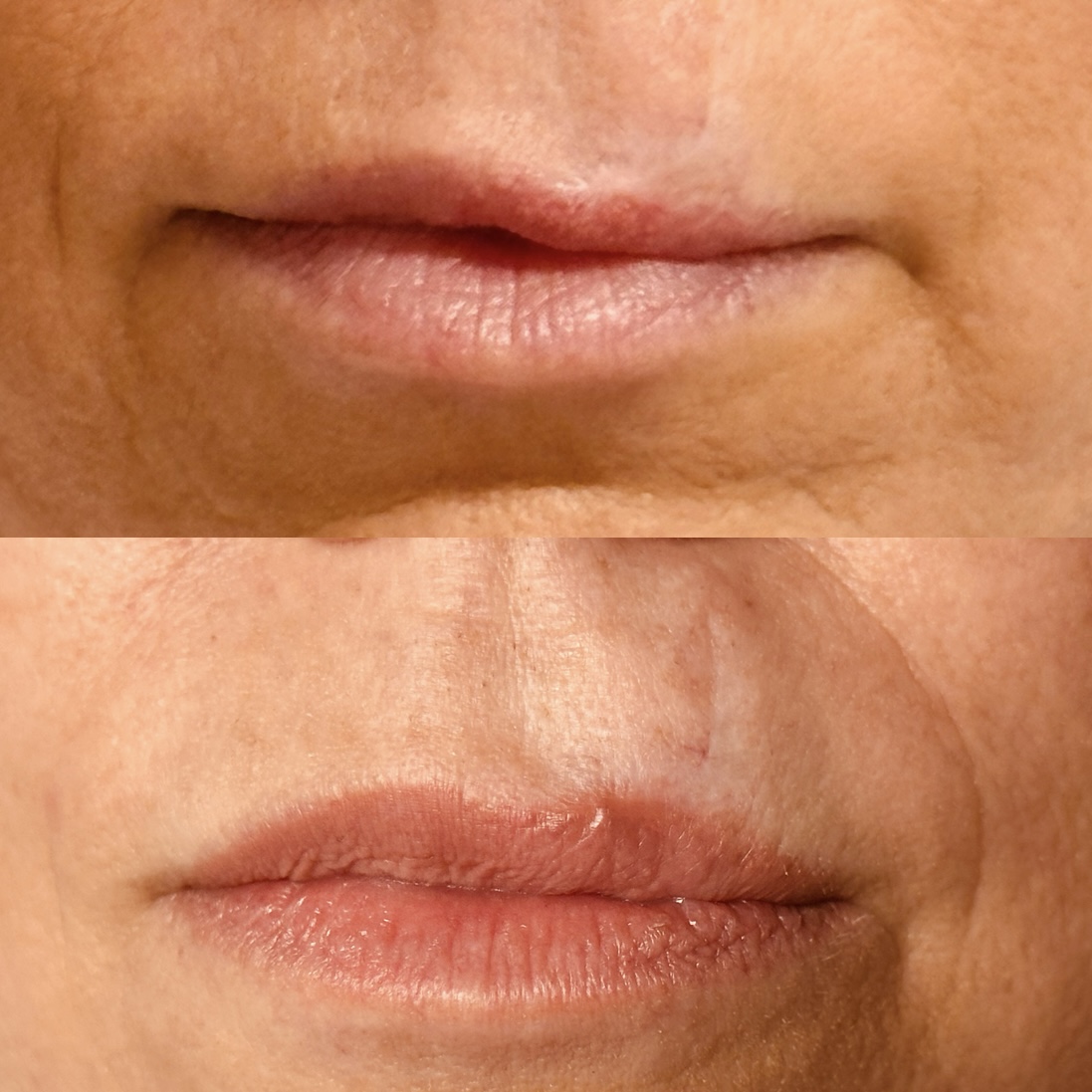 Before and After Image: Lip Blushing - front